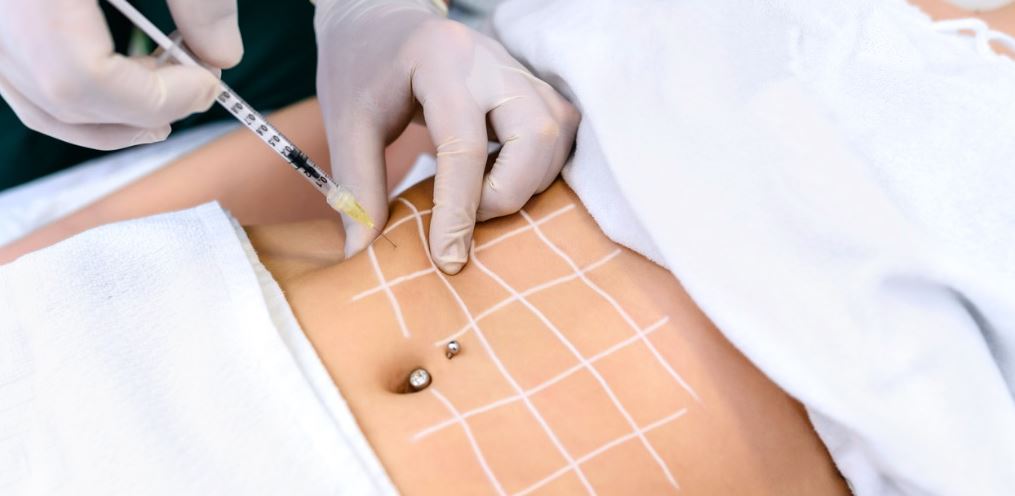 Injectable Fat-Dissolving Treatments